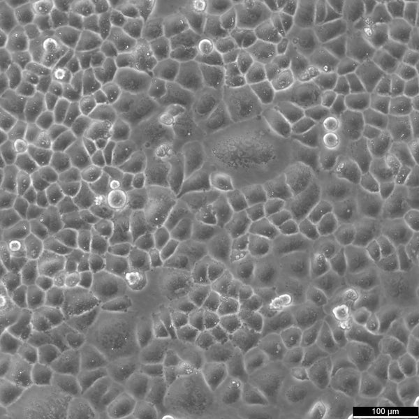 SW-13 cell