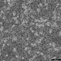 SW-872 cell