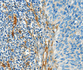 DIO2 Polyclonal Antibody – Figure 1 of 2