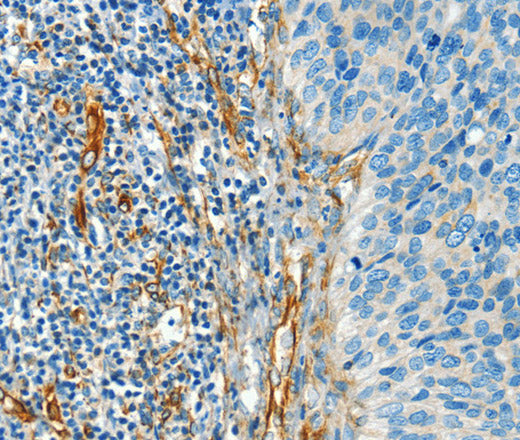 DIO2 Polyclonal Antibody – Figure 1 of 2