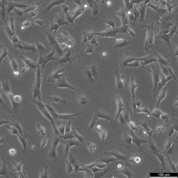 SW-579 cell