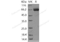 Recombinant Human EphB1/EPHT2 Protein (aa 565-984, His & GST Tag) – Figure 1 of 2