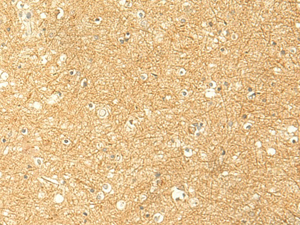 RNF148 Polyclonal Antibody – Figure 1 of 2