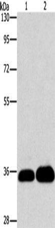 LIN28B Polyclonal Antibody – Figure 1 of 2