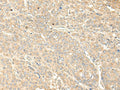 WDFY4 Polyclonal Antibody – Figure 1 of 2