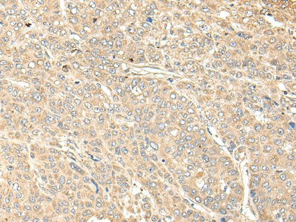 WDFY4 Polyclonal Antibody – Figure 1 of 2
