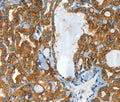 CLPTM1L Polyclonal Antibody – Figure 1 of 3