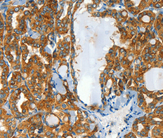 CLPTM1L Polyclonal Antibody – Figure 1 of 3