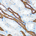 PIK3CA Polyclonal Antibody – Figure 1 of 6