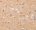 HDAC8 Polyclonal Antibody – Figure 1 of 3