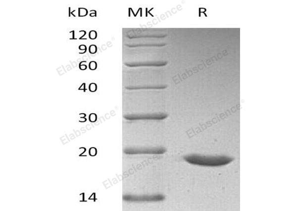 Recombinant Human SUMO3/SMT3A Protein (His Tag) – Figure 1 of 2