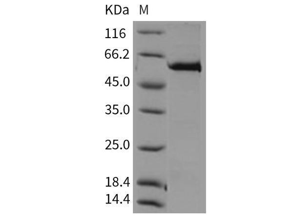 Recombinant Mouse MERTK/MER Protein (His & GST Tag) – Figure 1 of 2