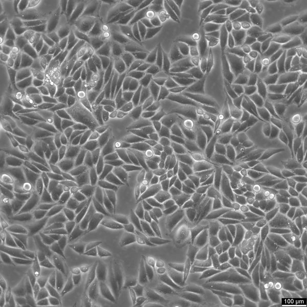 SiHa cell