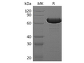 Recombinant E.coli Beta-Glucuronidase/Uida/Beta-Gus Protein (His Tag) – Figure 1 of 2