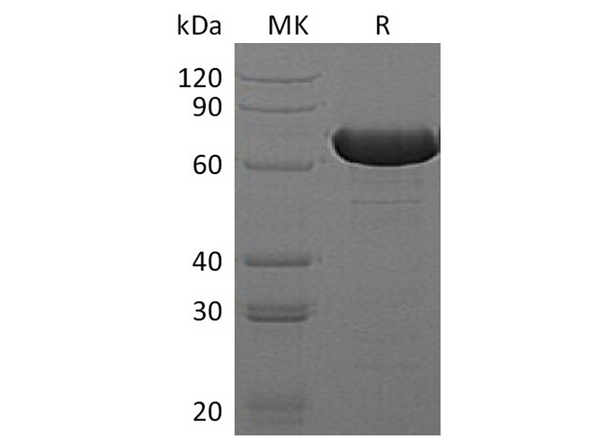 Recombinant E.coli Beta-Glucuronidase/Uida/Beta-Gus Protein (His Tag) – Figure 1 of 2