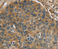 RIPK4 Polyclonal Antibody – Figure 1 of 3