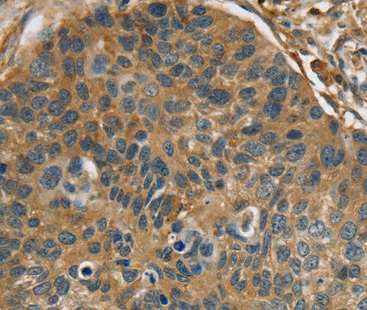 RIPK4 Polyclonal Antibody – Figure 1 of 3
