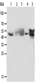 CK-19 Polyclonal Antibody – Figure 1 of 3