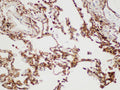 S100A4 Polyclonal Antibody – Figure 1 of 6