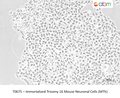 Immortalized Trisomy 16 Mouse Neuronal Cells (MTh) – Figure 1 of 1