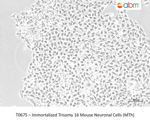Immortalized Trisomy 16 Mouse Neuronal Cells (MTh) – Figure 1 of 1
