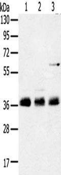 ANKRD1 Polyclonal Antibody – Figure 1 of 2