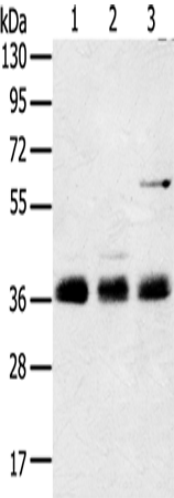 ANKRD1 Polyclonal Antibody – Figure 1 of 2