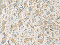 PDE4DIP Polyclonal Antibody – Figure 1 of 2