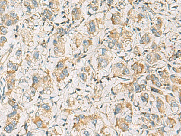 PDE4DIP Polyclonal Antibody – Figure 1 of 2