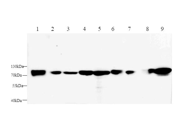 AFP Polyclonal Antibody – Figure 1 of 3