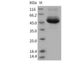 Recombinant Human Cathepsin A/CTSA Protein (His Tag) – Figure 1 of 2