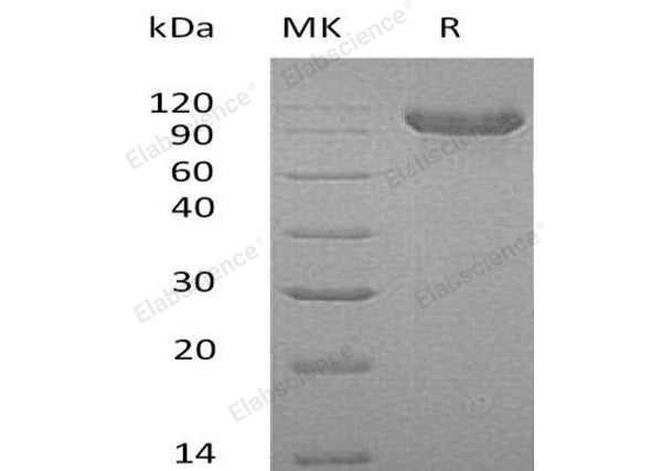 Recombinant Human Cadherin-16/CDH16 Protein (His Tag) – Figure 1 of 2