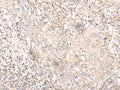 IL24 Polyclonal Antibody – Figure 1 of 3