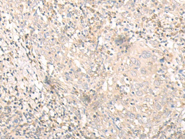IL24 Polyclonal Antibody – Figure 1 of 3