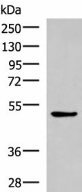 BLNK Polyclonal Antibody – Figure 1 of 4