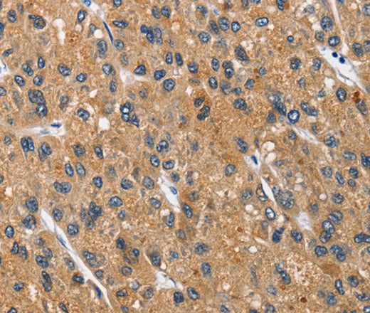 CEACAM3 Polyclonal Antibody – Figure 1 of 3