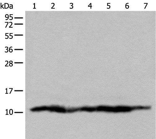 UQCRQ Polyclonal Antibody – Figure 1 of 3