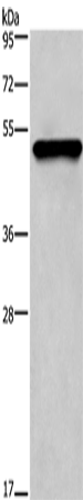 CK-14 Polyclonal Antibody – Figure 1 of 2
