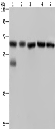 NUP62 Polyclonal Antibody – Figure 1 of 3