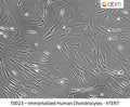 Immortalized Human Chondrocytes - hTERT | Applied Biological Materials (abm)