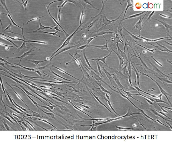 Immortalized Human Chondrocytes - hTERT | Applied Biological Materials (abm)