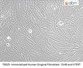 Immortalized Human Gingival Fibroblast - SV40 and hTERT | Applied Biological Materials (abm)