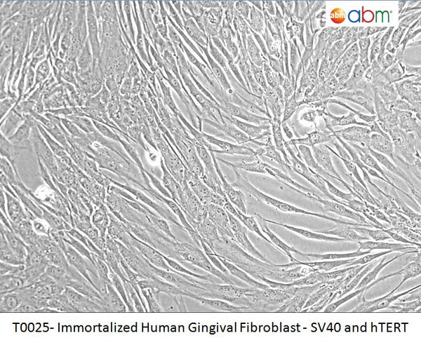 Immortalized Human Gingival Fibroblast - SV40 and hTERT | Applied Biological Materials (abm)