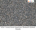 Primary Human Hepatocytes, Metabolism Qualified, Plateable | Applied Biological Materials (abm)