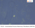 Immortalized Human Mammary Fibroblasts (HMF3A) | Applied Biological Materials (abm)