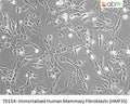 Immortalized Human Mammary Fibroblasts (HMF3S) | Applied Biological Materials (abm)