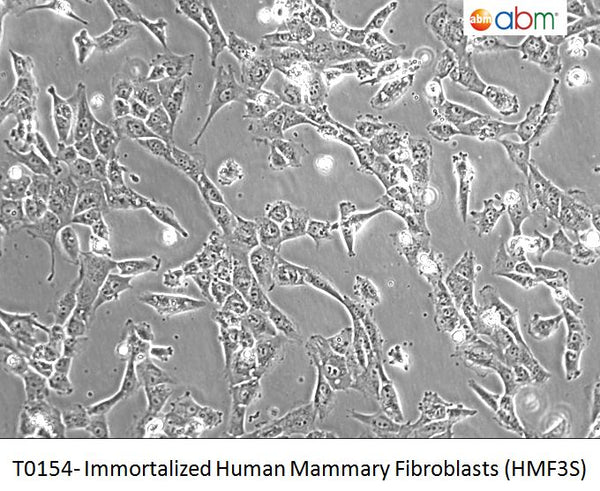 Immortalized Human Mammary Fibroblasts (HMF3S) | Applied Biological Materials (abm)