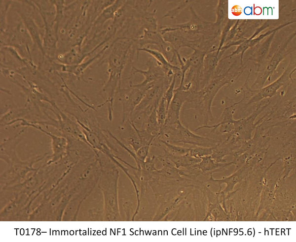 Immortalized NF1 Schwann Cell Line (ipNF95.6) - hTERT | Applied Biological Materials (abm)