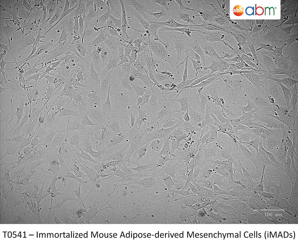 Immortalized Mouse Adipose-derived Mesenchymal Cells (iMADs) | Applied Biological Materials (abm)