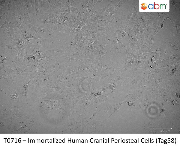 Immortalized Human Cranial Periosteal Cells (Tag58) | Applied Biological Materials (abm)